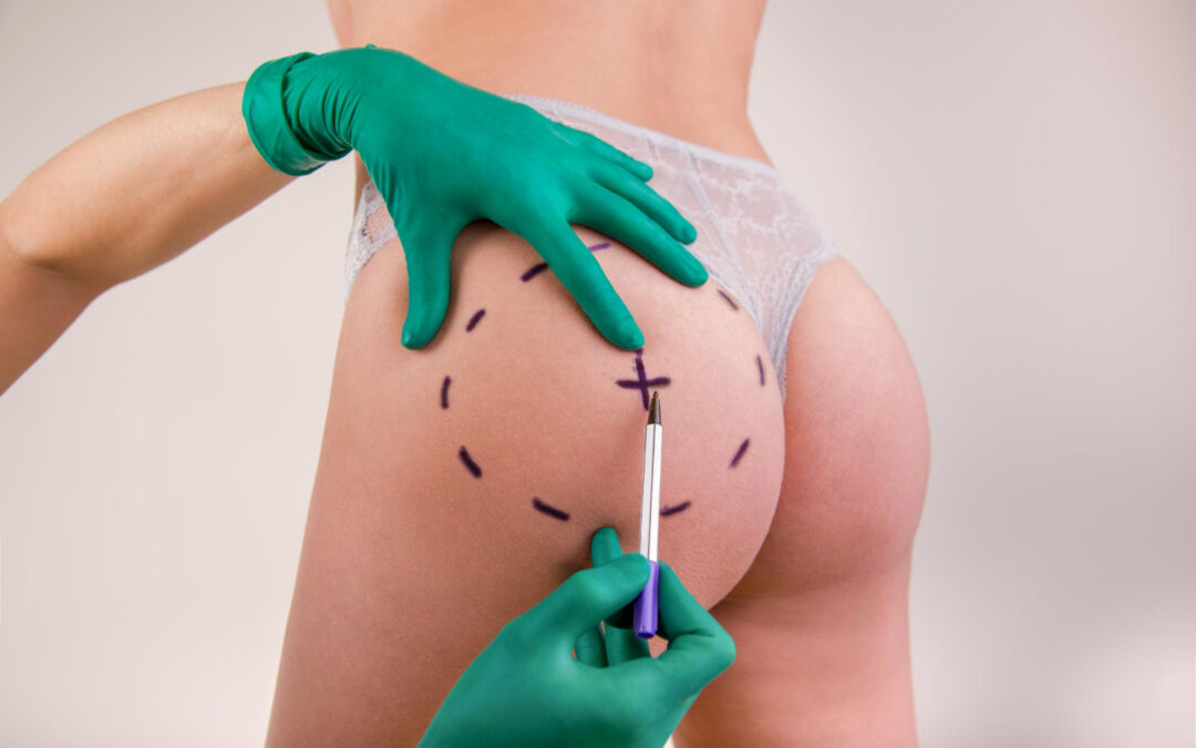 How to Choose a Plastic Surgeon*