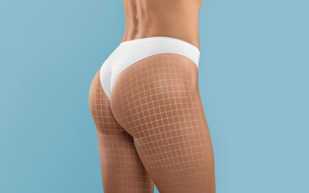How to Fix a Droopy Butt*