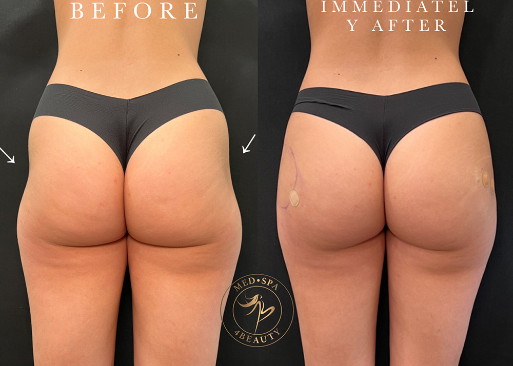 Actual Patient before and after results