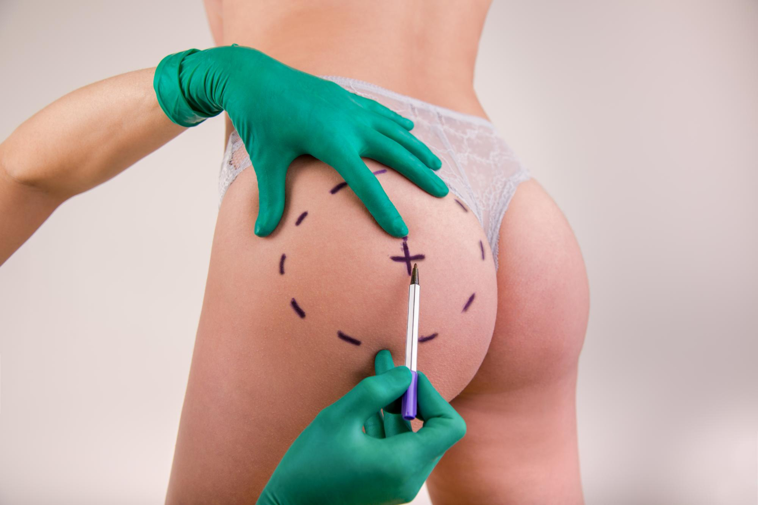 how to choose a plastic surgeon