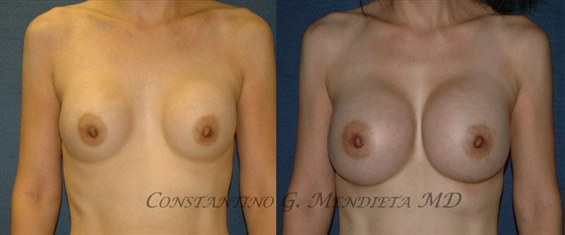 Before and After Image