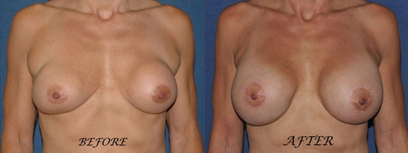 Before and After Image