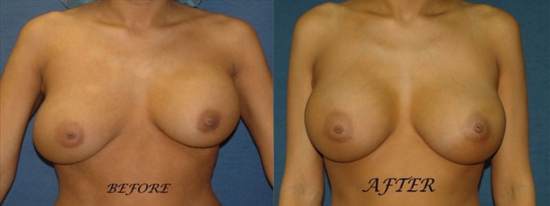 Before and After Image