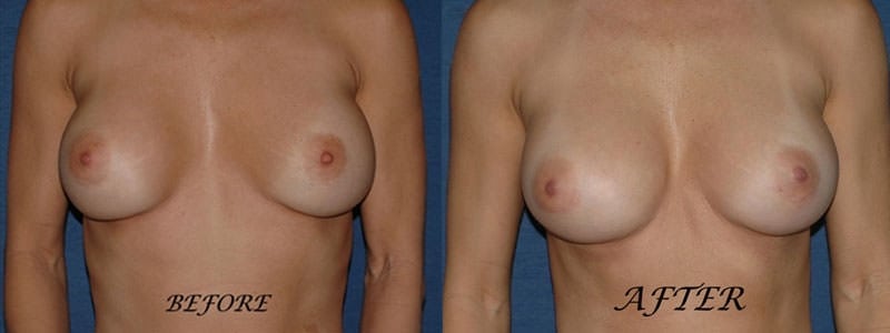 Before and After Image