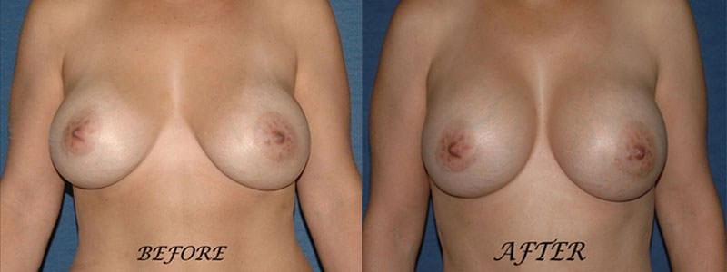 Before and After Image