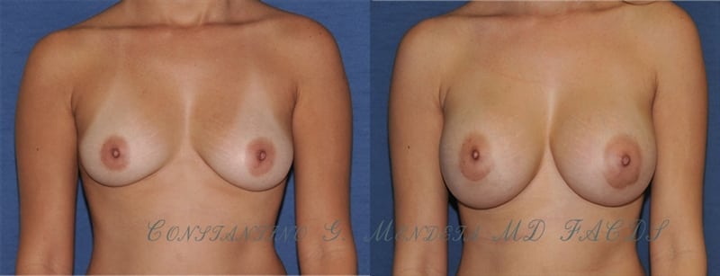 Before and After Image