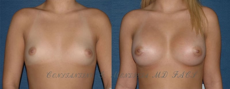 Before and After Image