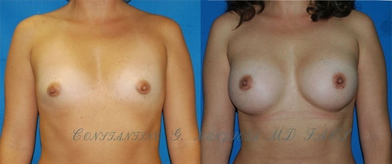 Before and After Image