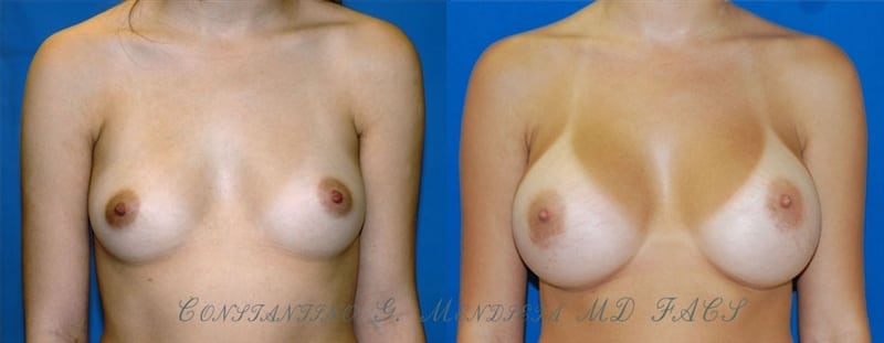 Before and After Image