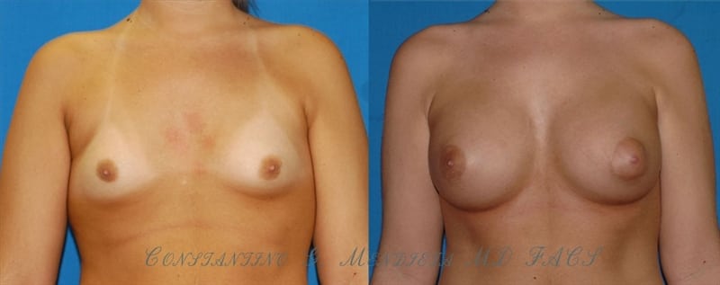 Before and After Image