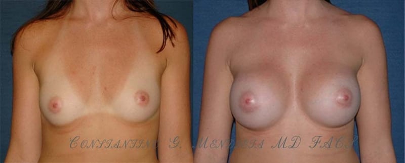 Before and After Image