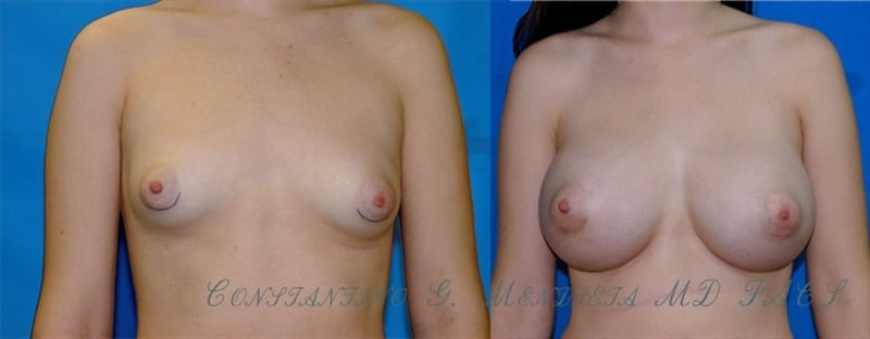 Before and After Image