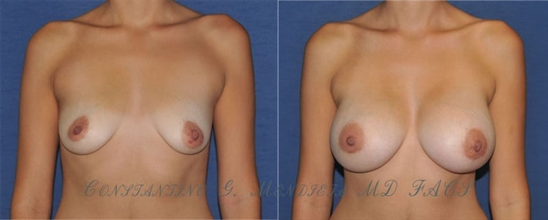 Before and After Image