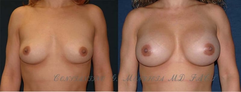 Before and After Image
