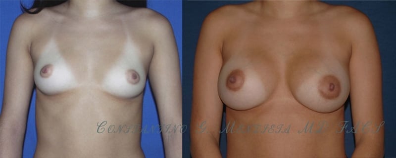 Before and After Image