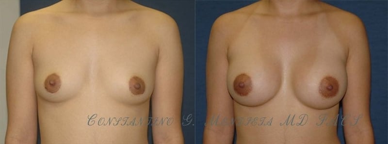 Before and After Image