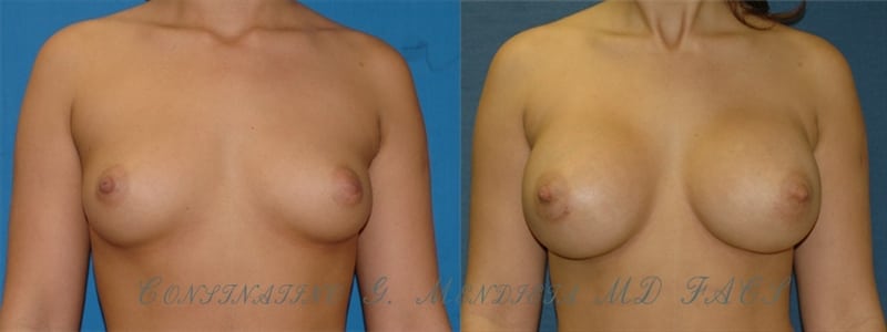 Before and After Image