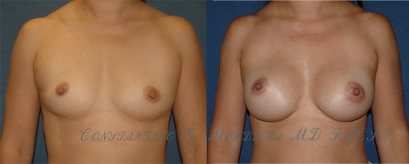 Before and After Image
