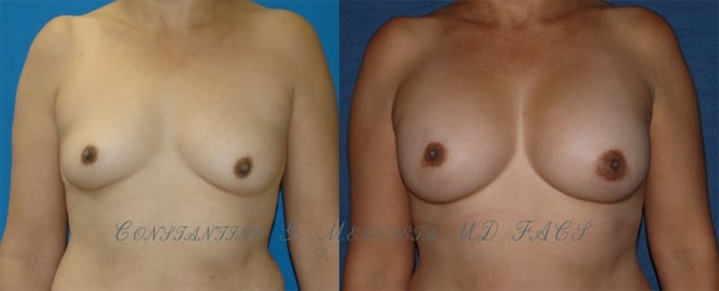 Before and After Image
