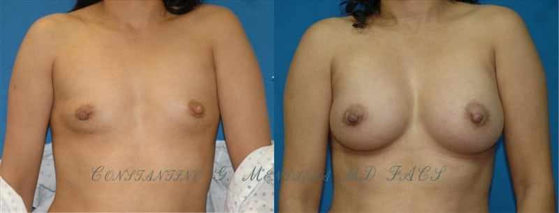 Before and After Image