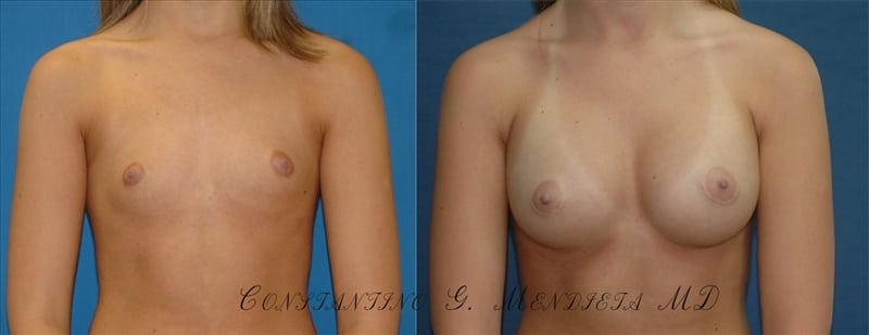 Before and After Image