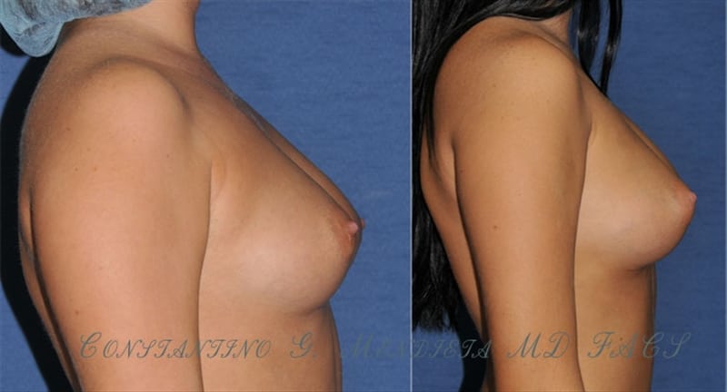 Before and After Image