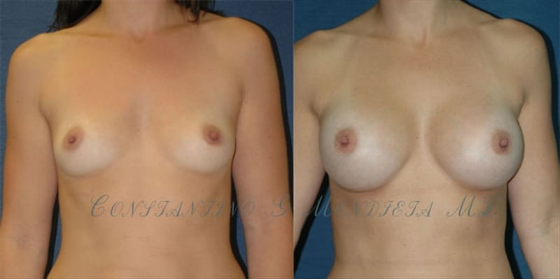 Before and After Image