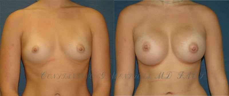 Before and After Image