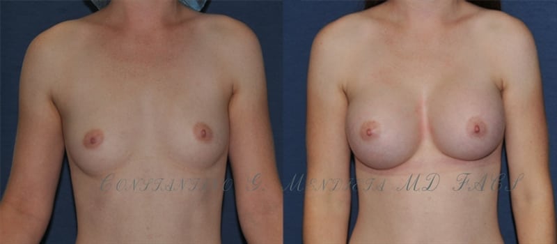 Before and After Image