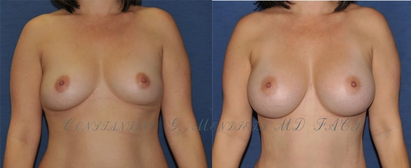Before and After Image