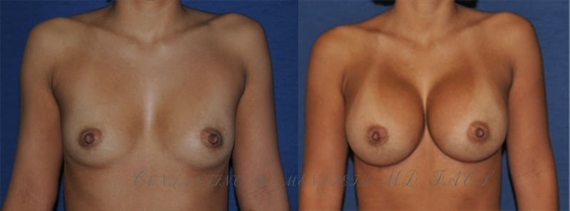 Before and After Image