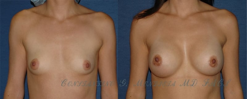 Before and After Image