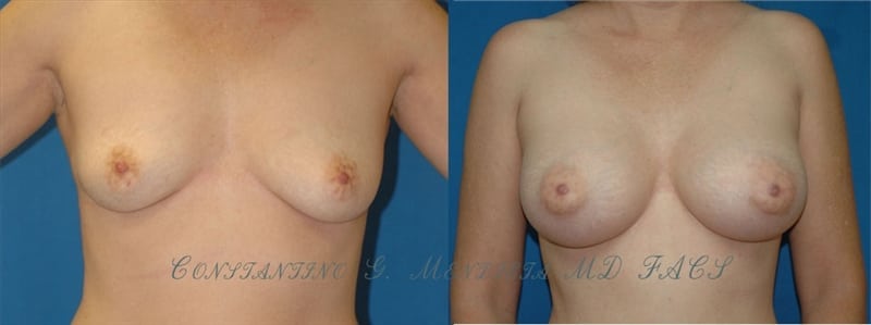 Before and After Image