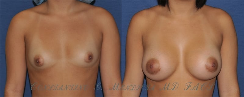 Before and After Image