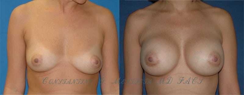 Before and After Image