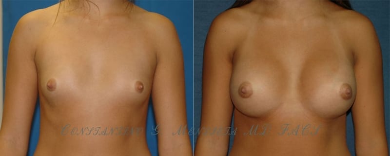 Before and After Image