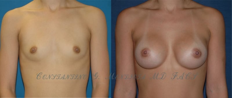 Before and After Image