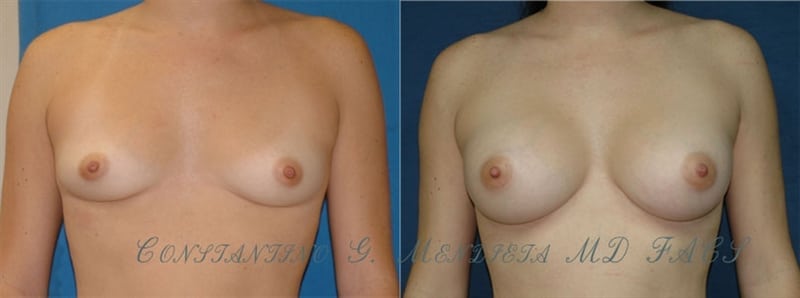 Before and After Image