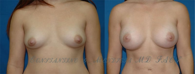 Before and After Image