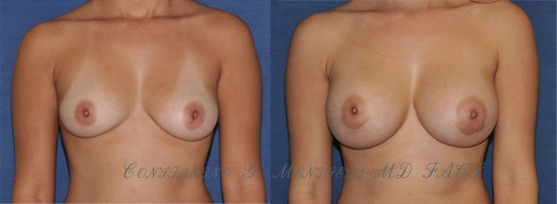 Before and After Image