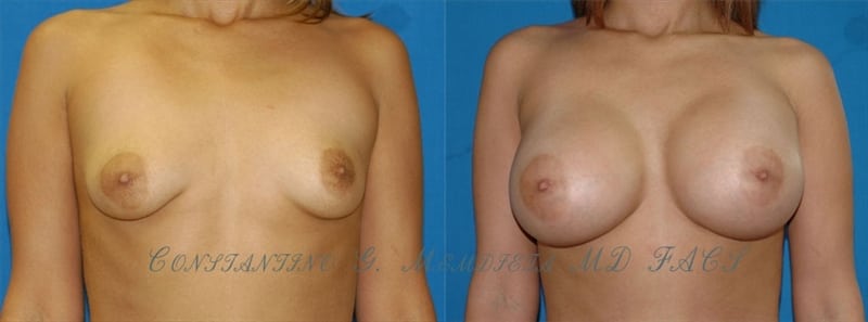 Before and After Image