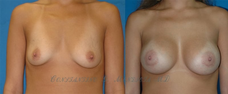 Before and After Image