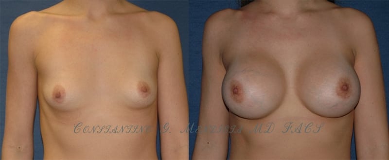 Before and After Image