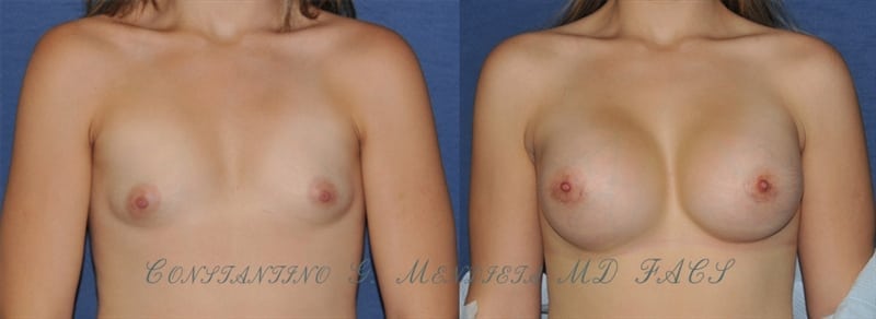 Before and After Image