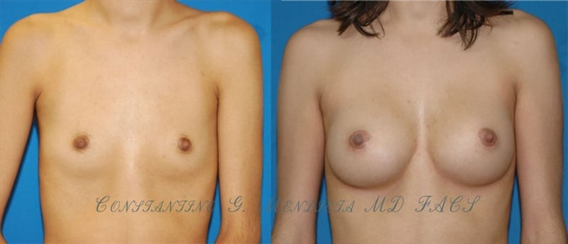 Before and After Image
