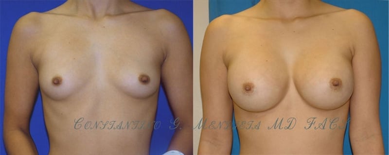 Before and After Image