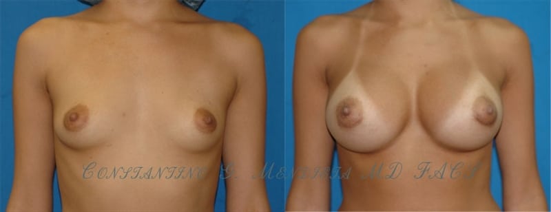 Before and After Image