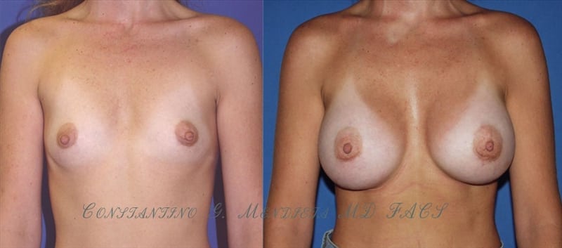 Before and After Image