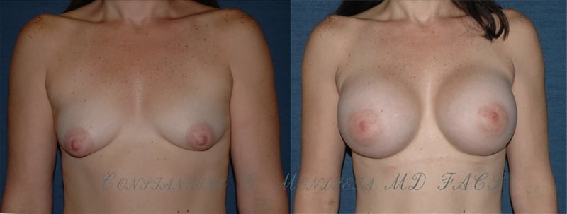 Before and After Image