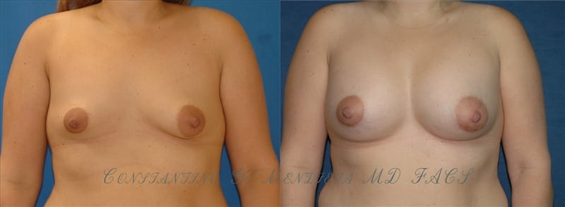Before and After Image